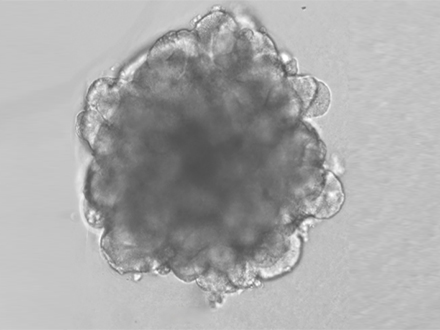 脑类器官×脑机接口